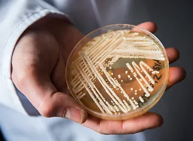 Texas A&M biologist James Smith's outstretched hand holds a petri dish containing a fungal specimen