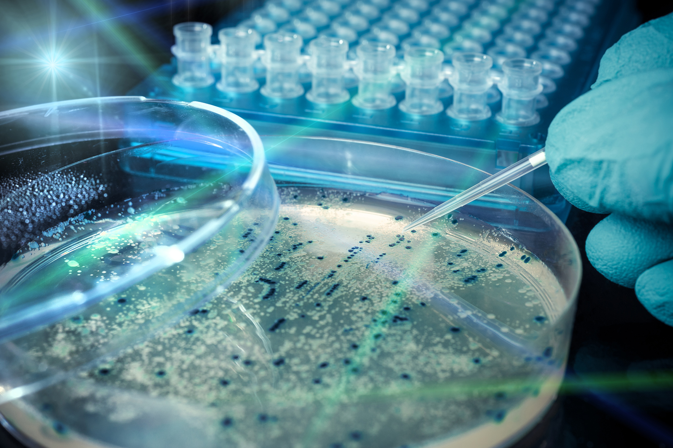 A researcher wearing blue latex gloves works with bacterial colonies in a petri dish with a rack of test tubes and other laboratory supplies shown in the background